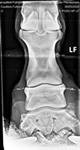 Radiographie 4 (full rocker)