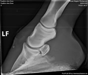 Radiographie 3 (sans fer)