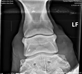 Radiographie 4 (sans fer)